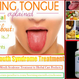 11-Natural-Remedies-for-Burning-Mouth-Syndrome