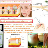 14-Herbal-Cures-for-Sebaceous-Cyst