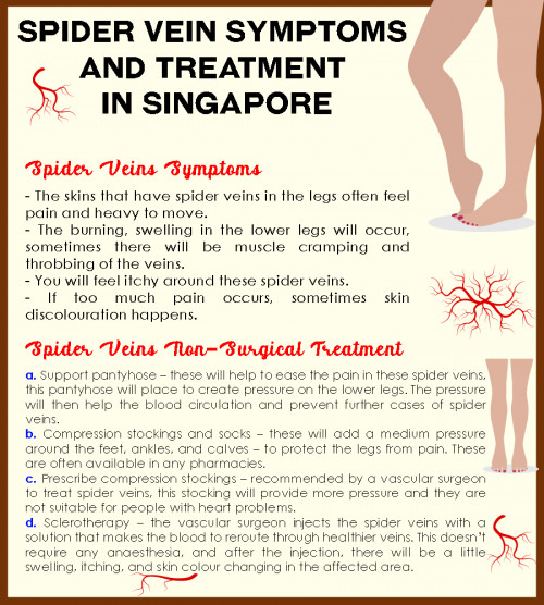 Are you thinking of getting a spider vein treatment? Check this out to learn more about the types of treatment you can get.

#SpiderVeinTreatmentSingapore

https://veinandendovascularsurgery.sg/spider-veins/