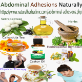 6-Home-Remedies-for-Abdominal-Adhesions