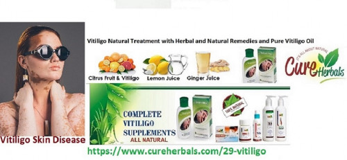 A-Vitiligo-and-its-Treatment-with-Herbal-and-Natural-Remedies-and-Pure-Vitiligo-Oil.jpg