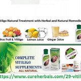 A-Vitiligo-and-its-Treatment-with-Herbal-and-Natural-Remedies-and-Pure-Vitiligo-Oil