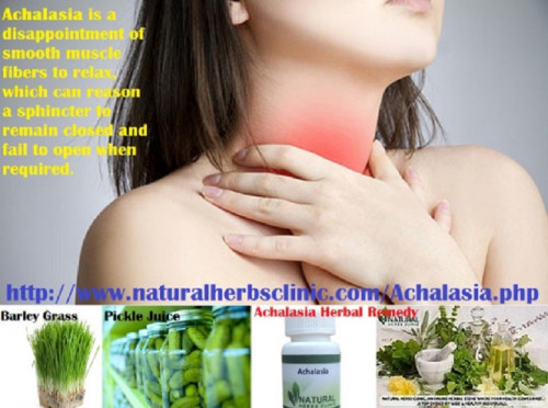 Herbal Remedies for Achalasia by Natural Herbs Clinic is one of the positive medications for Achalasia Herbal Treatment. It is herbal formula and has no any side effects in treating achalasia... https://naturalcureproducts.wordpress.com/2017/02/18/symptoms-and-management-of-achalasia-infection/