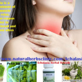 Achalasia-Herbal-Treatment