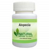 Alopecia-Natural-Herbal-Treatment-500x500-1