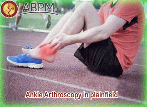 Ankle Arthroscopy in plainf