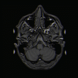 Brain_MRI_T1_movie