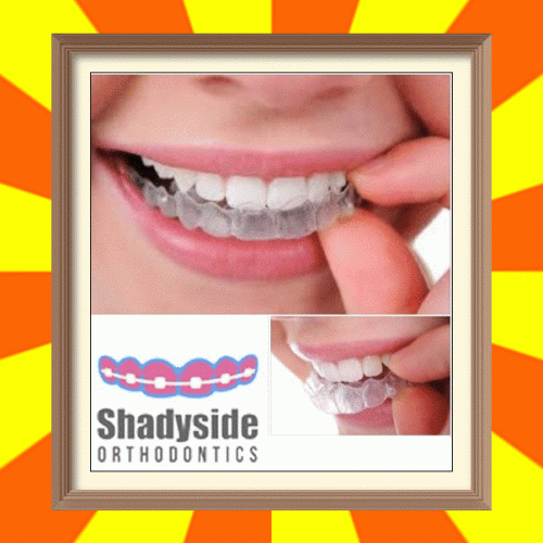 For clear braces in Shadyside, PA visit Shadyside Orthodontics treatment center. Dr. Maria is certified and expert in all kinds of orthodontics and also deal in braces. She is a member of AAO & certified ABO dentist. For free consultation & appointment, visit our website today. For more information visit our website, https://bit.ly/2Vxbikj