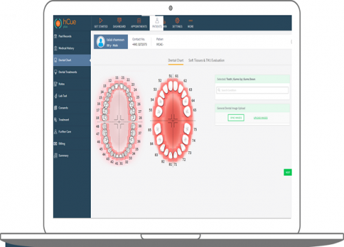 It's only natural for you to desire the very best for your dental practice. The monitoring software application is a vital aspect if you actually intend to boost your office's procedures, yet you'll have to brace yourself for the price of the best dental administration software. In this market, you obtain what you pay for cloud-based dental software.

#Dental #software #practice #management #programs #office

Web: https://www.dentidesk.com/en/