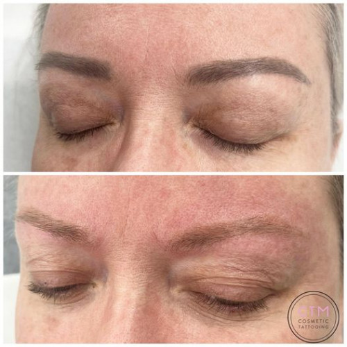 If you choose a highly experienced practitioner at Cosmetic Tattooing Melbourne who will consult with you before your treatment and answer any question you have, laser removal for eyebrow tattooing is a safe procedure. For more information, explore the website https://cosmetictattooingmelbourne.com.au/eyebrow-tattooing/

#CosmeticTattooingMelbourne #eyebrowtattooing #eyebrowtattooingnearme #cosmetictattooing