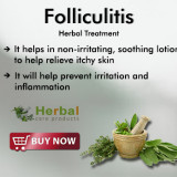 Folliculitis