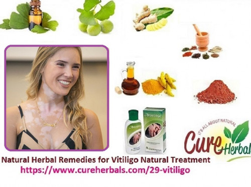 Get-Rid-of-Vitiligo-in-short-time-with-Natural-Herbal-Remedies.jpg