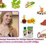 Get-Rid-of-Vitiligo-in-short-time-with-Natural-Herbal-Remedies