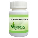 Granuloma-Annulare-Herbal-Treatment-228x228