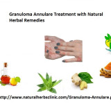 Granuloma-Annulare-Treatment-with-Natural-Herbal-Remedies