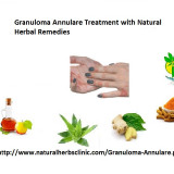Granuloma-Annulare-Treatment-with-Natural-Herbal-Remediesa203f1115c72a085