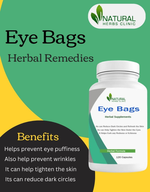 Natural Treatment for Eye Bags is an all-natural solution for reducing the appearance of eye bags. With regular use, this natural treatment visibly reduces puffiness and dark circles around the eyes while hydrating the skin. Natural Treatment for Eye Bags is an effective, safe, and easy way to reduce the appearance of eye bags without any irritation. https://www.naturalherbsclinic.com/product/eye-bags/