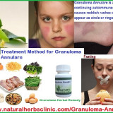 Herbal-Treatment-for-Granuloma-Annulare