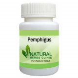 Herbal-Treatment-for-Pemphigus