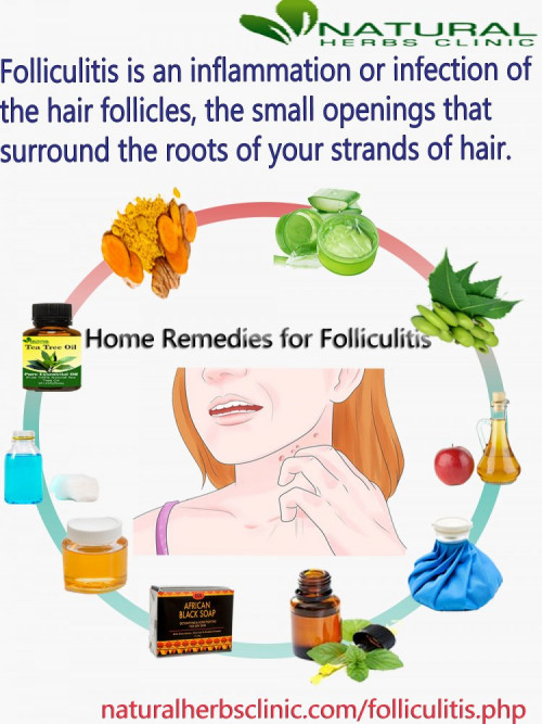 Colloidal silver is another one of the simple yet effective Natural Remedies for Folliculitis. It is effective against bacteria and fungi; hence it can deal with the root cause of the problem... https://www.dubaient.com/natural-remedies-for-folliculitis