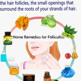 Home-Remedies-for-Folliculitis