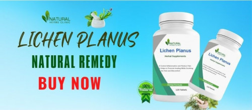 Do you get lichen planus discomfort? Get the relief you deserve with our herbal medicine and stop suffering in silence! Our Best Home Remedies for Lichen Planus have been shown to help lessen symptoms. With a Lichen Planus herbal product from us now, you can get your life back on track and take advantage of living a healthier lifestyle.
https://www.naturalherbsclinic.com/product/lichen-planus/