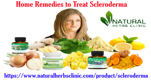 Ginger is one of the well known elements to add on Natural Remedies for Scleroderma because it has strong antioxidant and anti-inflammatory properties that help inhibit pain-producing prostaglandins in your body... http://herbsnaturalclinic.weebly.com/blog/home-remedies-to-treat-scleroderma