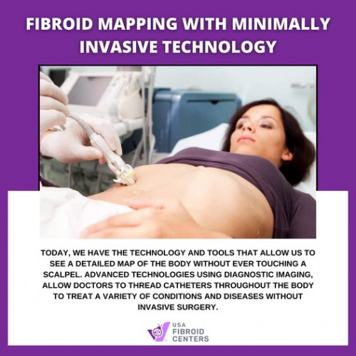 How-UFE-Can-Give-You-Freedom-From-Fibroids.jpg