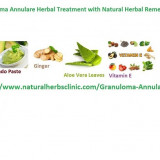 How-to-Treat-Granuloma-Annulare-with-Natural-Herbal-Remedies-and-Using-Natural-Essential-Oil787006d44ffd4713