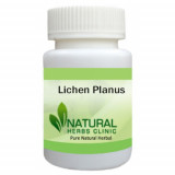 Lichen-Planus-Herbal-Treatment-500x500-1