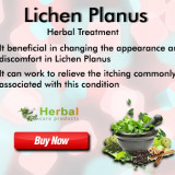 Lichen-Planus