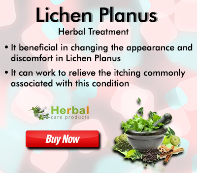 Lichen-Planus45343e9d0ade3f09.jpg