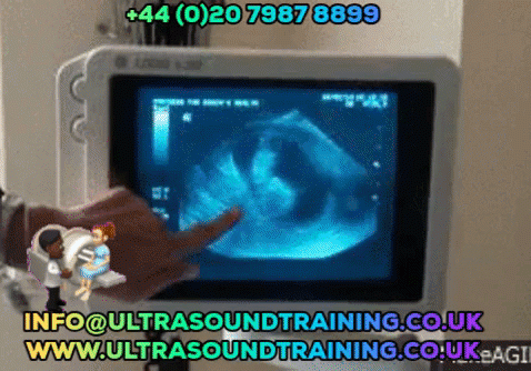 Are you looking for getting training for Msk Ultrasound Imaging? Then don’t look further then SMUGUK. Visit www.ultrasoundtraining.co.uk
