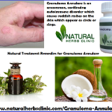 Natural-Herbal-Remedies-and-Oil-for-Granuloma-Annulare-Herbal-Treatment6a9a0870a27734dd