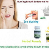 Natural-Herbal-Remedies-for-Burning-Mouth-Syndrome-Reduce-the-Irritating-Condition