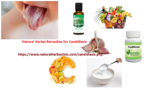 Peppermint Oil is an excellent Herbal Treatment for Candidiasis, also called as oral yeast infection. The menthol content of peppermint has been shown to be effective in killing the fungi responsible for causing yeast infections... https://fails.us/blog/view/4019/natural-herbal-remedies-for-candidiasis-how-to-cure-candidiasis-naturally-and-permanently