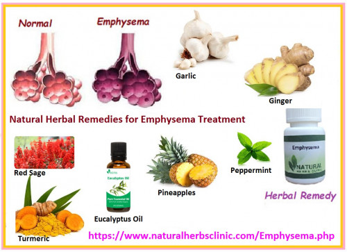 Ginger is quite easy to use and one of the most useful Herbal Treatment for Emphysema. Just add the root of this vegetable into boiling water to make an herbal tea or add it directly to your everyday meals... https://www.naturalherbsclinic.com/blog/natural-herbal-remedies-for-herbal-treatment-for-emphysema-and-manage-with-symptoms-naturally/