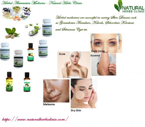 There are numerous Natural Remedies for Skin Diseases which promises to offer a disease-less skin. As these natural remedies are too many in numbers, then it is very tricky to select the best of them... https://www.naturalherbsclinic.com/blog/natural-herbal-remedies-for-skin-diseases/