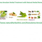 Natural-Herbal-Treatment-For-Granuloma-Annulare