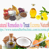 Natural-Remedies-for-Eczema-in-Children