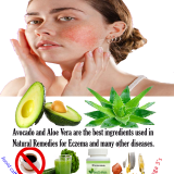 Natural-Remedies-for-Eczema