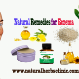 Natural-Remedies-for-Eczema940b52bcda09fff4