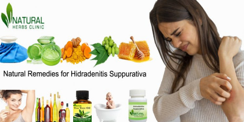 Natural-Remedies-for-Hidradenitis-Suppurativa.jpg