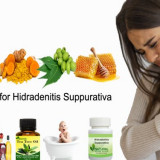 Natural-Remedies-for-Hidradenitis-Suppurativa