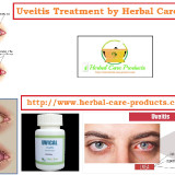 Natural-Treatment-for-Uveitis