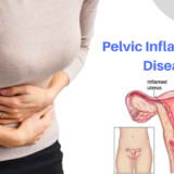 Pelvic-Inflammatory-Disease.png