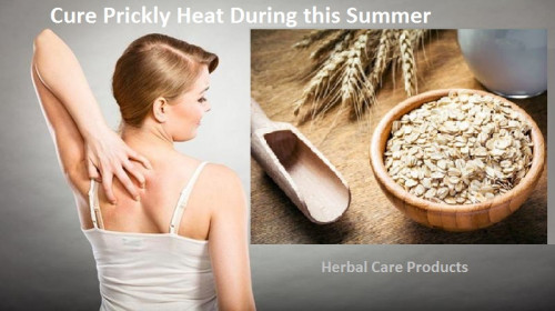 Herbal Remedies for Prickly Heat everybody is looking for natural solution of their entire heat rash problem. Herbal products for Prickly Heat very helpful for heat rash treatment.
https://www.herbal-care-products.com/blog/how-to-cure-prickly-heat-rash-during-this-summer/