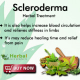 Scleroderma