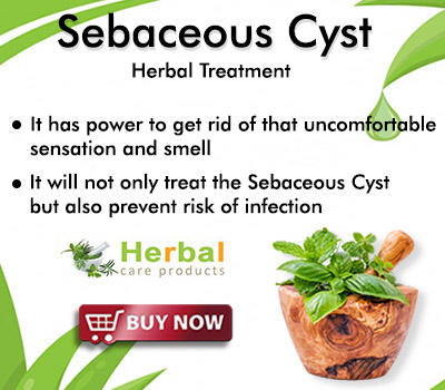 Sebaceous-Cyst.jpg