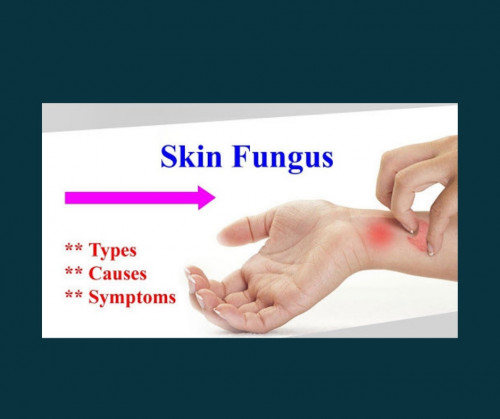 Skin-Fungus.jpg
